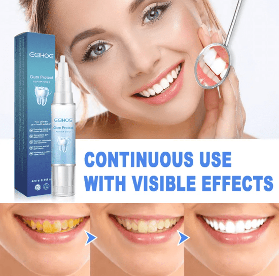 Teeth Repair Gel - Y Files