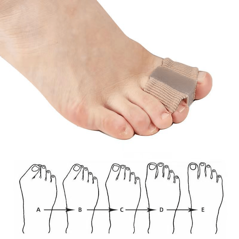 Fiber Toe Separator - Y Files