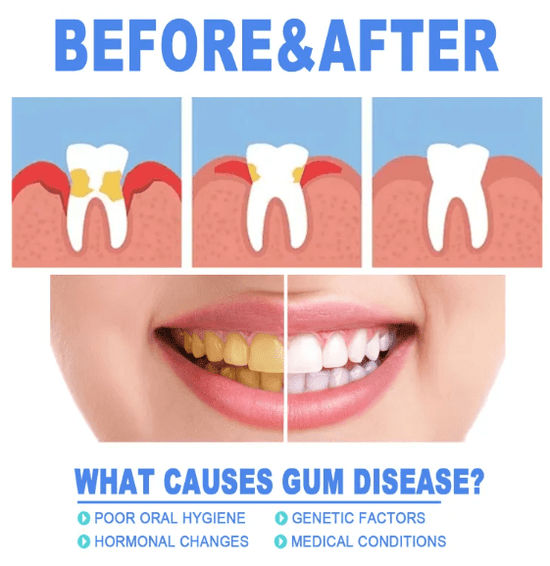 Teeth Repair Gel - Y Files