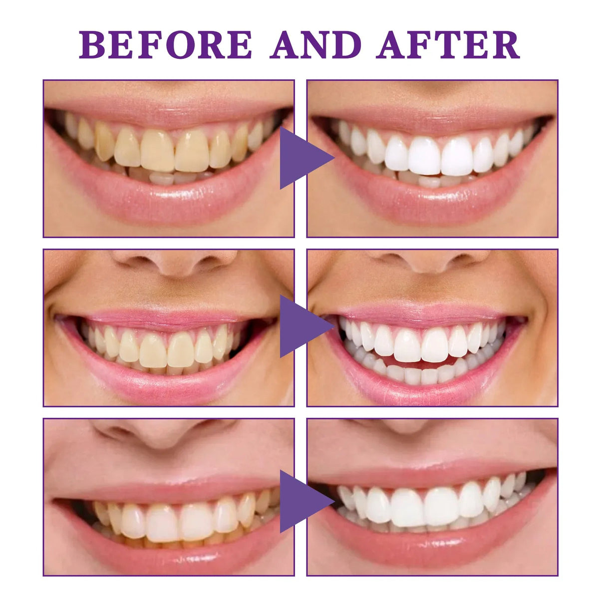 V34 Tooth Cleaning Mousse - Y Files