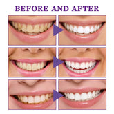 V34 Tooth Cleaning Mousse - Y Files